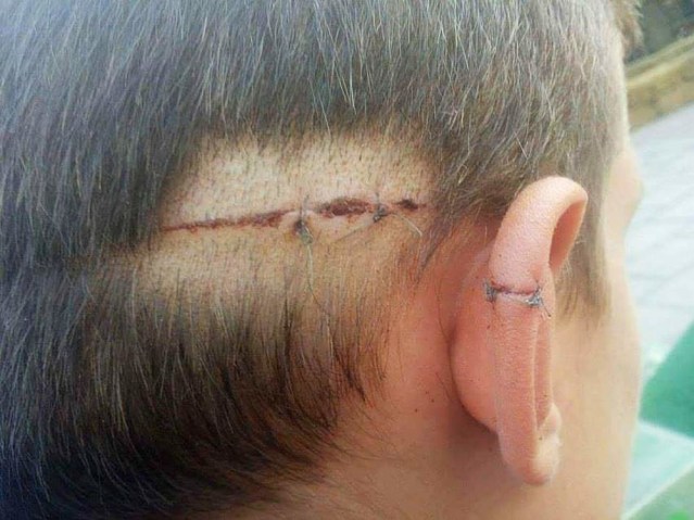 Повређени дечак, Фото: РАС